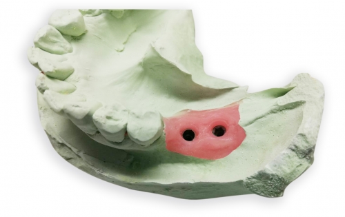 A-Silcone for gingival 人工牙齦複製材料