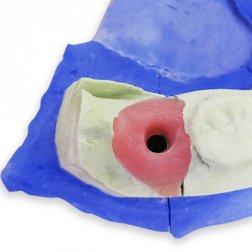 A-Silcone for gingival 人工牙齦複製材料