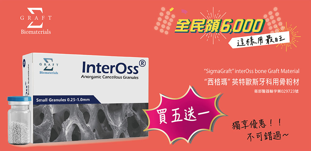 InterOSS優惠